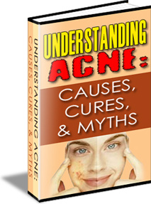 Ebook cover: Understanding Acne - Causes, Cures, & Myths