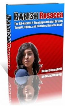 Ebook cover: Banish Rosacea