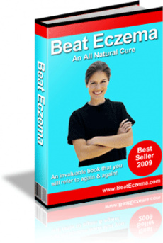 Ebook cover: Beat Eczema