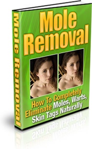 Ebook cover: How to Completely Remove Moles and Warts Naturally!