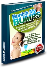 Ebook cover: Banish My Bumps